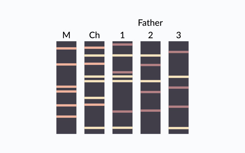 Wikimedia DNA paternity testing diagram. Results of genetic fingerprinting.