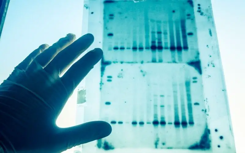 dna genetic analysis results